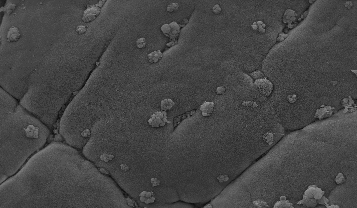 צילום מכיוון חלל המעי אל פני השטח שלהם באמצעות מיקרוסקופ אלקטרונים סורק. ניתן לראות קבוצות של בועיות בולטות מפני השטח של תאי הגביע, בדרכן להשתחרר אל תוך חלל המעי. בעכבר נטול אינפלמזום הבועיות בולטות אך אינן מופרשות